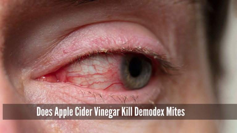 Does Apple Cider Vinegar Kill Demodex Mites on Humans, Does Apple Cider Vinegar Kill Demodex Mites