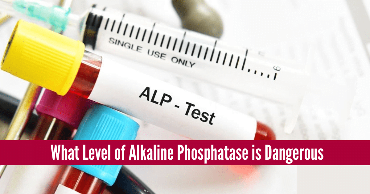 What Level of Alkaline Phosphatase is Dangerous