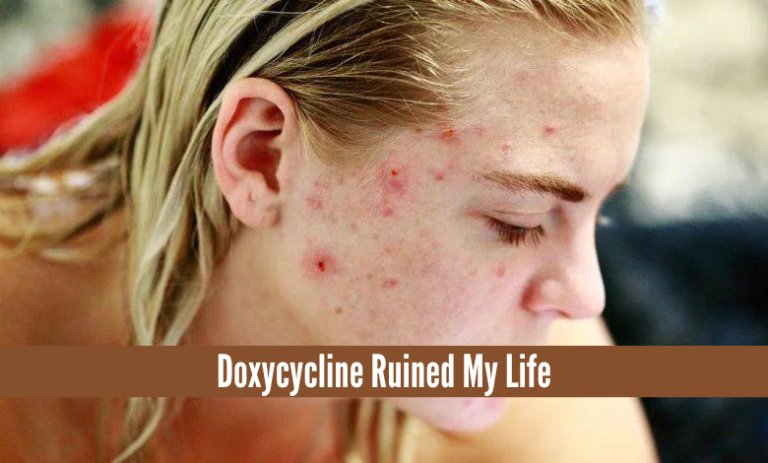 Doxycycline Ruined My Life