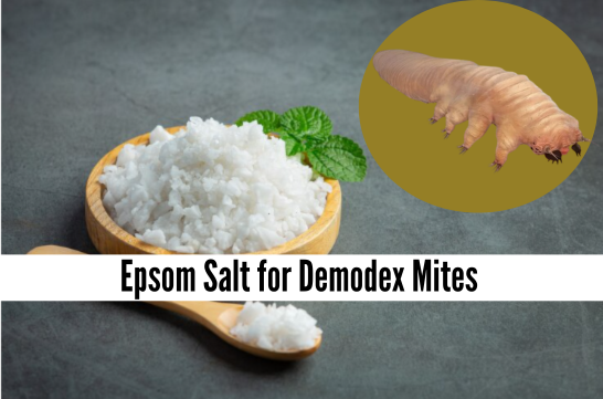 epsom salt for demodex mites