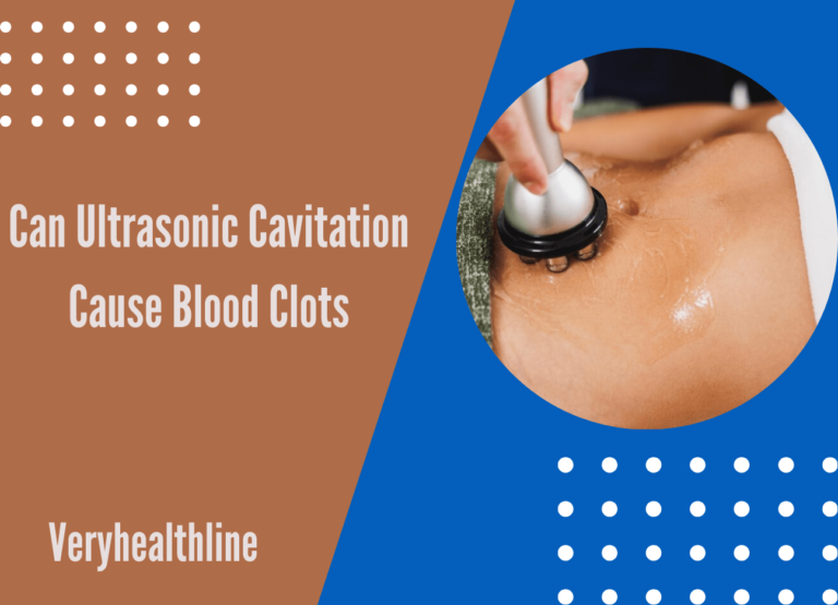 Can Ultrasonic Cavitation Cause Blood Clots