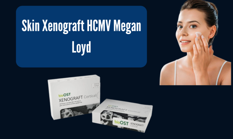 Skin Xenograft HCMV megan loyd