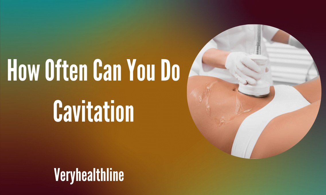 how often can you do cavitation