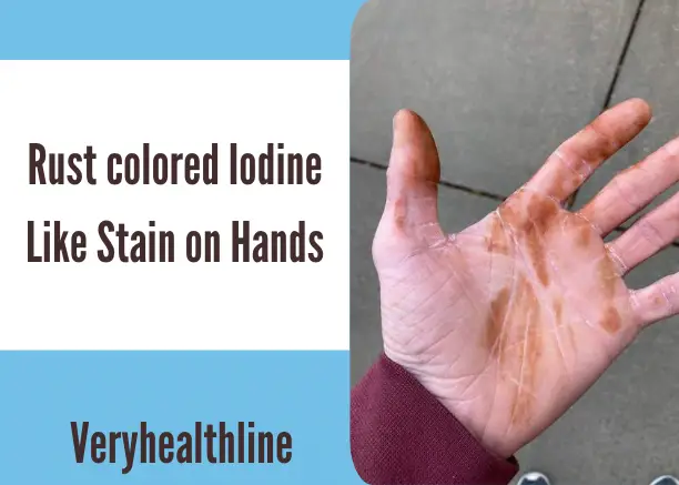 Rust colored Iodine Like Stain on Hands